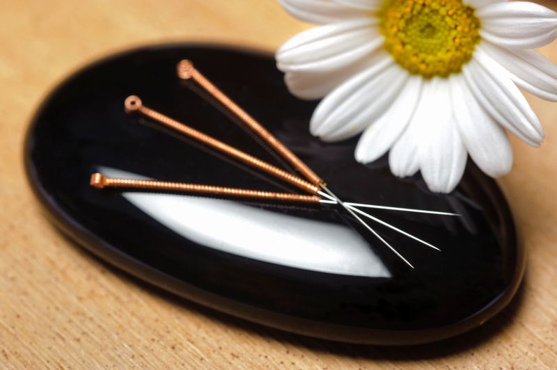 Acupuncture in West LA